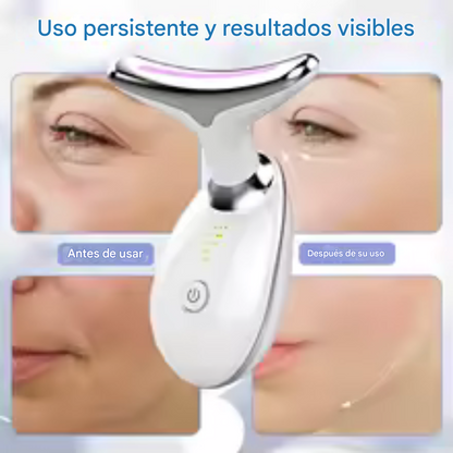 Masajeador Facial Lifting EMS + Limpiador de Puntos Negros (GRATIS)